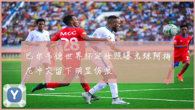 巴尔韦德世界杯定妆照曝光琼阿梅尼冲突留下明显伤痕